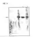 Fig. 04 - PURIFICATION OF PROTEINS WITH CATIONIC SURFACTANT