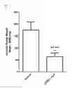 Fig. 02 - siRNA structures for high activity and reduced off target