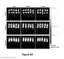 Fig. 09 - Stabilization of poly(A) sequence encoding DNA sequences