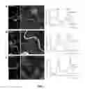 Fig. 02 - PLANTS WITH ENHANCED RESISTANCE TO PHYTOPHTHORA