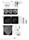 Fig. 06 - PLANTS WITH ENHANCED RESISTANCE TO PHYTOPHTHORA