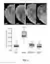 Fig. 09 - PLANTS WITH ENHANCED RESISTANCE TO PHYTOPHTHORA