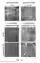 Fig. 12 - PLANTS WITH ENHANCED RESISTANCE TO PHYTOPHTHORA