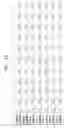 Fig. 15 - METHODS OF USING SINGLE NUCLEOTIDE POLYMORPHISMS IN THE TL1A GENE TO PREDICT OR DIAGNOSE INFLAMMATORY BOWEL DISEASE