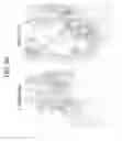 Fig. 50 - METHODS OF USING SINGLE NUCLEOTIDE POLYMORPHISMS IN THE TL1A GENE TO PREDICT OR DIAGNOSE INFLAMMATORY BOWEL DISEASE