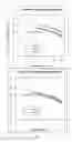Fig. 07 - METHOD FOR DETERMINING A SUPPLEMENT COMPOSITION FOR PREVENTING DEVELOPMENT OF DRY INTERMEDIATE AGE-RELATED MACULAR DEGENERATION
