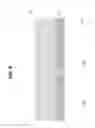 Fig. 09 - Method of coating both sides of a substrate using a sacrificial coating