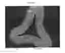 Fig. 02 - METALLIC FOAM BODY WITH CONTROLLED GRAIN SIZE ON ITS SURFACE, PROCESS FOR ITS PRODUCTION AND USE THEREOF