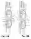 Fig. 10 - Shed forming device for a weaving machine