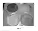 Fig. 07 - ANTIMICROBIAL TEXTILES AND METHODS FOR PRODUCTION OF THE SAME