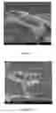 Fig. 02 - Cellulose microfibrils