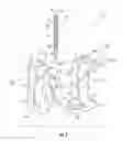 Fig. 03 - Wedge-based earth-working tooth adapter retention assembly