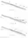 Fig. 03 - TOOL FOR USE WITH SHINGLE PATCH FOR HAIL DAMAGE REPAIR OF ASPHALT SHINGLES