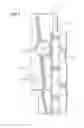 Fig. 08 - Expandable tool having helical geometry