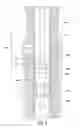 Fig. 03 - Active orientation of a reference wellbore isolation device