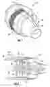 Fig. 02 - Cascade assembly for a thrust reverser of an aircraft nacelle
