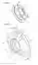 Fig. 06 - Reciprocating compressor crankshaft adapter and method