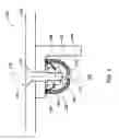 Fig. 03 - Methods for covering a portion of a fastener protruding from a surface
