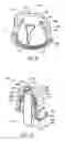 Fig. 07 - Methods for covering a portion of a fastener protruding from a surface