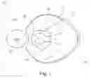 Fig. 02 - Device for actuating a clutch-controlled transfer case having a two-stage intermediate gearing and clutch-controlled transfer case that has a two-stage intermediate gearing and that is equipped with said device