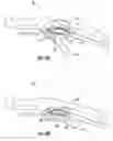 Fig. 03 - Cable actuator guide for liquid dispenser