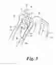 Fig. 06 - Hose clamp