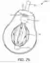 Fig. 15 - Lighting device, luminaire and manufacturing method