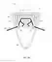 Fig. 05 - Lighting fixture with replaceable light engine