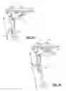 Fig. 06 - Bipod