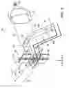 Fig. 07 - LASER DEVICE