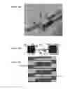 Fig. 12 - DNA detection method