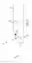 Fig. 04 - Apparatuses, methods, and systems for inspecting a composite end portion of a part