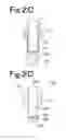 Fig. 04 - Preprocessing kit, preprocessing apparatus using said preprocessing kit to preprocess sample, and analysis system provided with said preprocessing apparatus