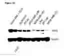 Fig. 05 - METHODS AND COMPOSITIONS FOR DETECTING AND MODULATING CANCER CELLS