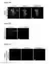 Fig. 23 - METHODS AND COMPOSITIONS FOR DETECTING AND MODULATING CANCER CELLS
