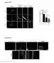 Fig. 28 - METHODS AND COMPOSITIONS FOR DETECTING AND MODULATING CANCER CELLS