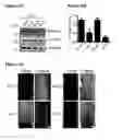 Fig. 30 - METHODS AND COMPOSITIONS FOR DETECTING AND MODULATING CANCER CELLS