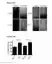 Fig. 32 - METHODS AND COMPOSITIONS FOR DETECTING AND MODULATING CANCER CELLS