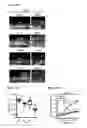 Fig. 33 - METHODS AND COMPOSITIONS FOR DETECTING AND MODULATING CANCER CELLS