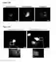 Fig. 35 - METHODS AND COMPOSITIONS FOR DETECTING AND MODULATING CANCER CELLS
