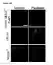 Fig. 67 - METHODS AND COMPOSITIONS FOR DETECTING AND MODULATING CANCER CELLS