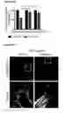 Fig. 72 - METHODS AND COMPOSITIONS FOR DETECTING AND MODULATING CANCER CELLS