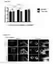 Fig. 74 - METHODS AND COMPOSITIONS FOR DETECTING AND MODULATING CANCER CELLS