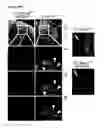Fig. 87 - METHODS AND COMPOSITIONS FOR DETECTING AND MODULATING CANCER CELLS