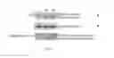 Fig. 03 - CHROMATIN-ACTIVITY-BASED CHEMOPROTEOMIC (CHAC) METHODS AND SYSTEMS FOR DISEASE MARKER DISCOVERY AND DEVELOPMENT