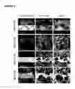 Fig. 03 - Method for diagnosing G-protein coupled receptor-related diseases