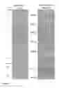 Fig. 05 - Crossmatching blood samples
