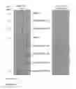 Fig. 07 - Crossmatching blood samples