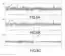 Fig. 04 - ULTRASONIC NOISE BASED SONAR