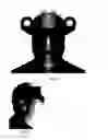Fig. 03 - Hands-free binocular device